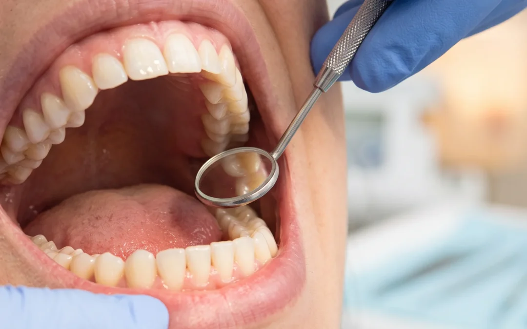 Razmak između implantata i susjednog zuba: kako utječe na kost, papilu i estetiku krunice